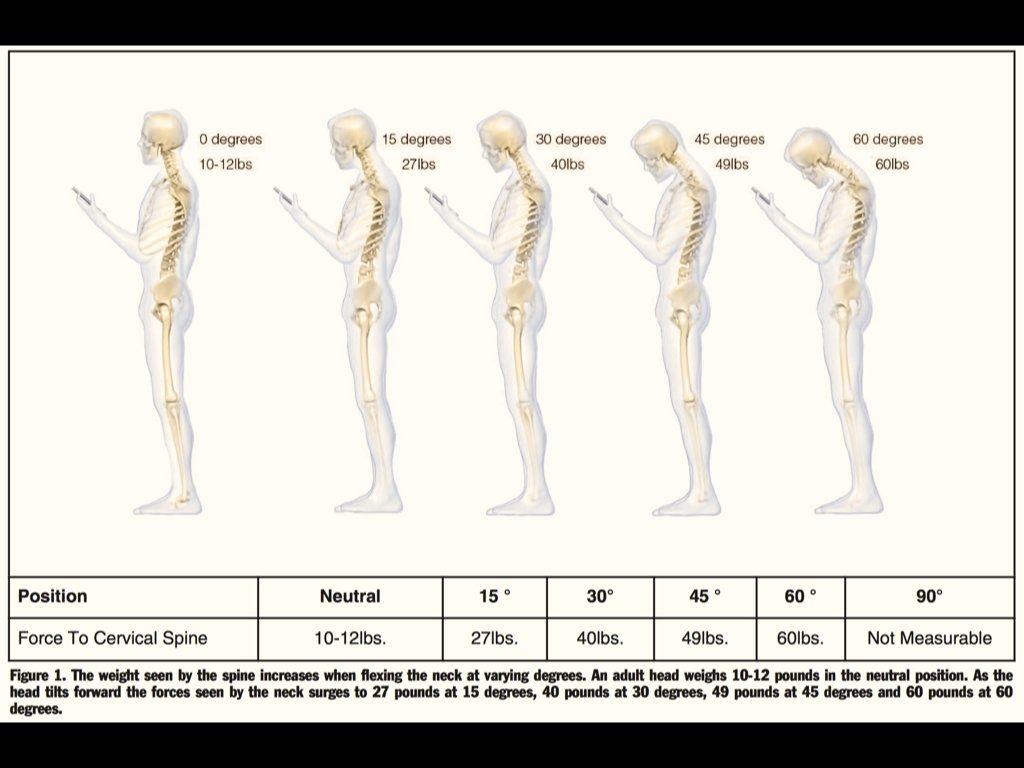 Tech neck: 7 things to do now to improve posture and relieve neck pain