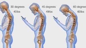 neck pain from smartphone