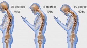 neck pain from smartphone