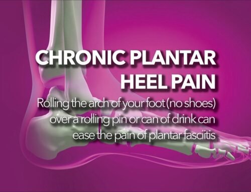 Heel Pain- Is It Plantar Fasciitis?