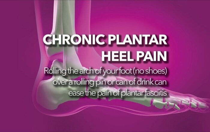 Heel pain and plantar fasciitis