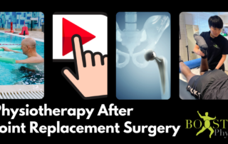Physio after joint replacement surgery