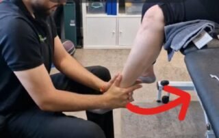 Stiff knee after knee replacement?