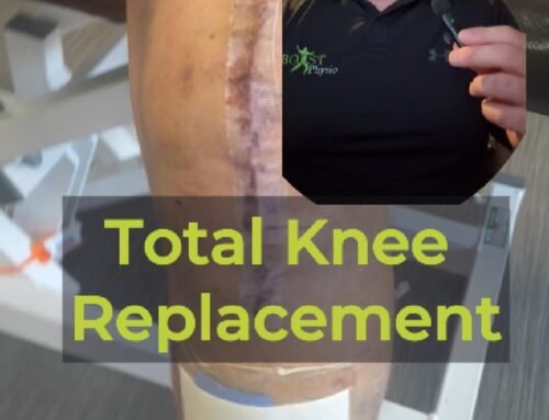 How will my knee look 2 weeks after a Total Knee Replacement?