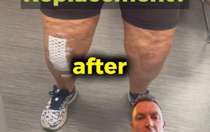 Rehab after surgery close to home